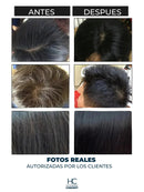 Shampoo Brimless Botánico – Canas Fuera en Segundos