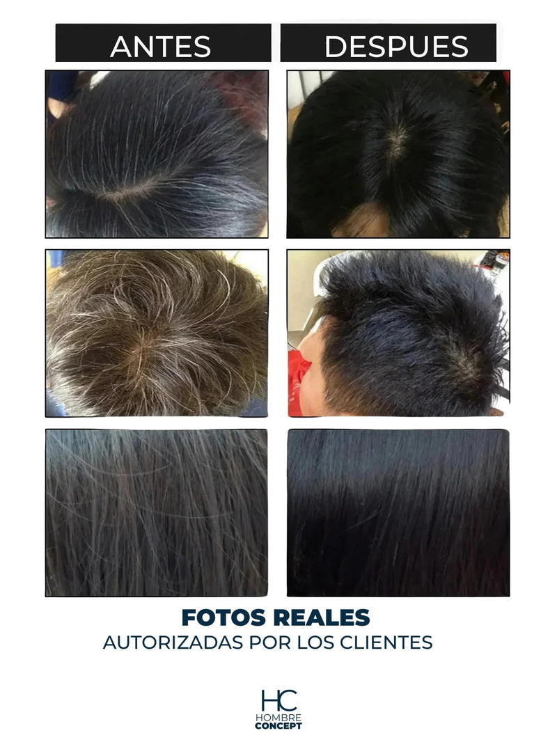 Shampoo Brimless Botánico – Canas Fuera en Segundos