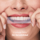 Kit Smile+ de Boqa – Blanqueamiento Dental sin Sensibilidad