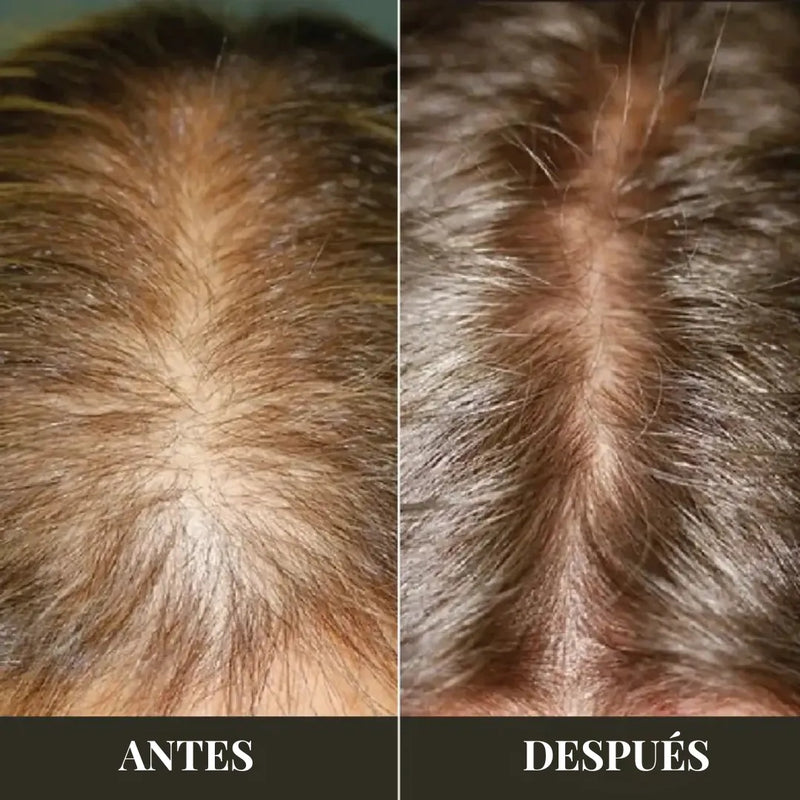 Aceite de Romero – Crecimiento y Fuerza Capilar
