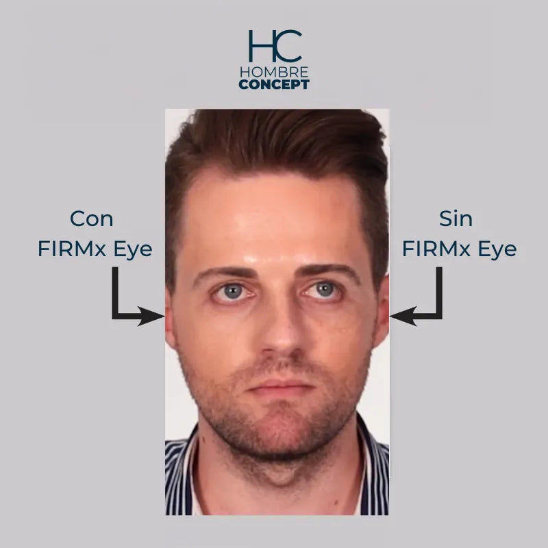 Instant FIRMx – Rejuvenece en 90 Segundos