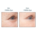 Instant FIRMx – Rejuvenece en 90 Segundos