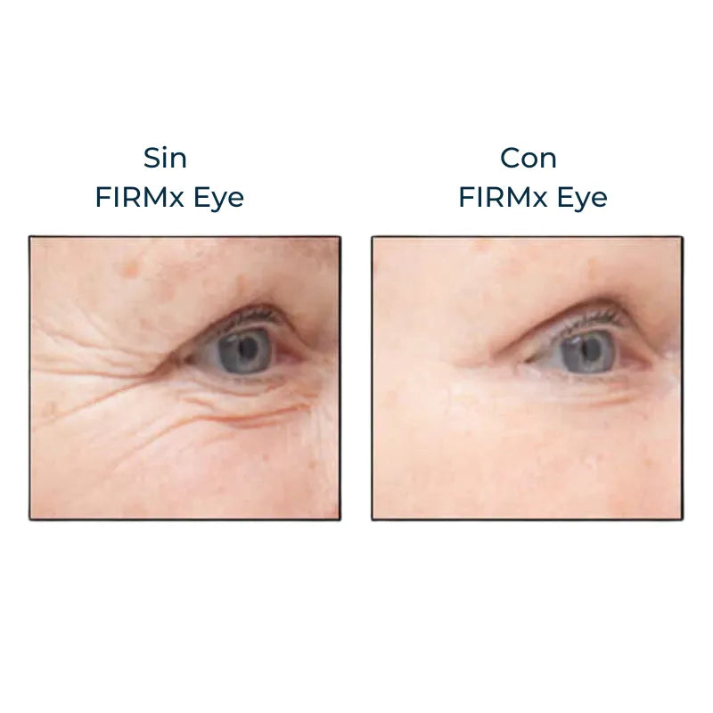 Instant FIRMx – Rejuvenece en 90 Segundos
